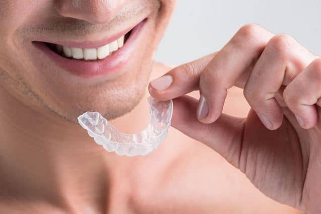 שיניים עקומות – גורמים ושיטות שונות של יישור שיניים