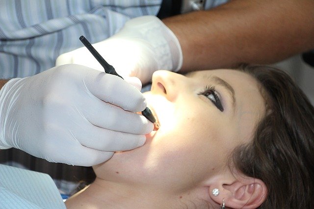 השתלות שיניים, עצם וחניכיים – מה כולל כל טיפול?